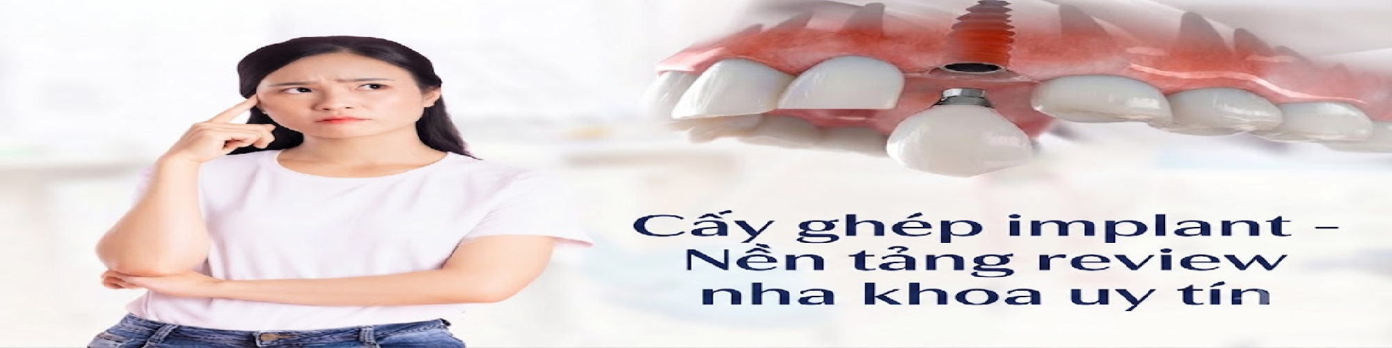 cayghepimplant